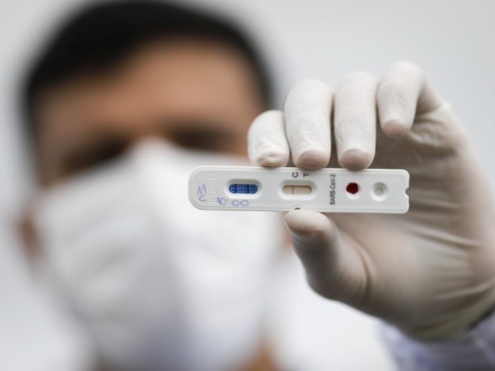 Covid19-Teste-Sangue-Coroanavirus-Brasilia-Estadio-ManeGarrincha-21Abr2020